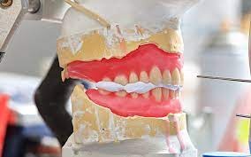 Super charge your dental esthetics